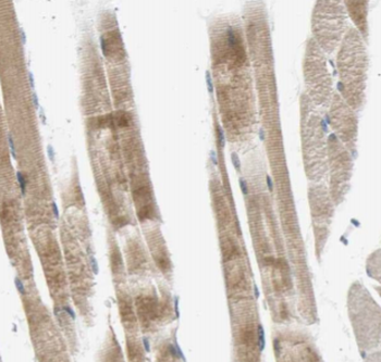 Creatine Kinase MM Specific Rabbit Polyclonal Antibody