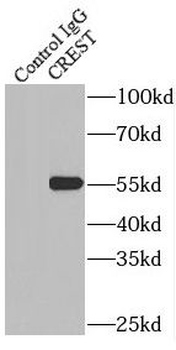 SS18L1 Antibody