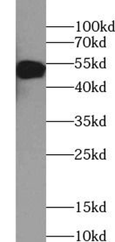 SS18L1 Antibody