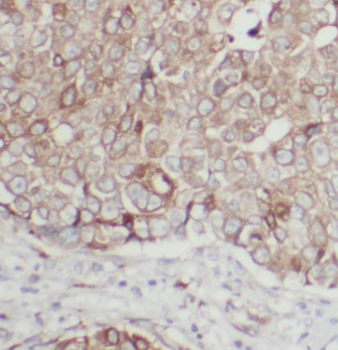 SRC Mouse Monoclonal Antibody