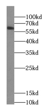 CCDC86 Rabbit Polyclonal Antibody