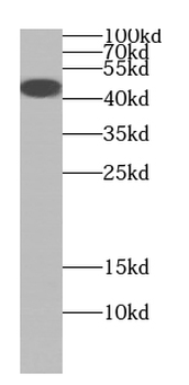 CYTH1 Rabbit Polyclonal Antibody