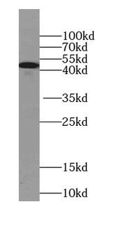 KRT13 Rabbit Polyclonal Antibody