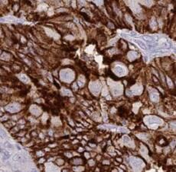 KRT13 Rabbit Polyclonal Antibody
