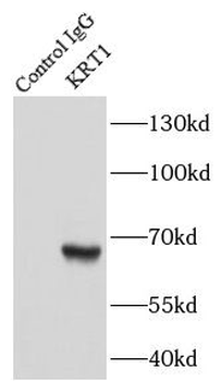 KRT1 Antibody