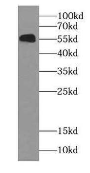 KRT6A Rabbit Polyclonal Antibody