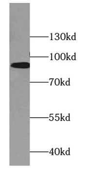 BRINP1 Mouse Monoclonal Antibody