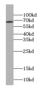 DDX5 Rabbit Polyclonal Antibody