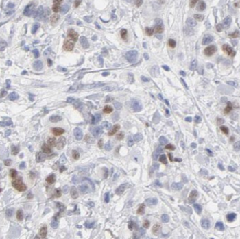 DDX5 Rabbit Polyclonal Antibody