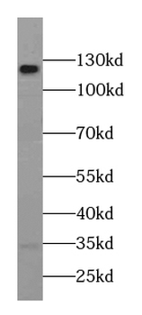 DGCR8 Mouse Monoclonal Antibody