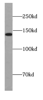 DIAPH1 Antibody
