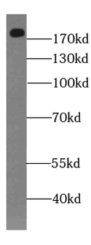 DOCK1 Antibody
