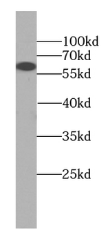 FIZ1 Antibody