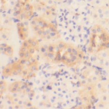 FIZ1 Antibody