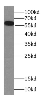 FIZ1 Antibody