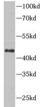 TNFRSF10B Antibody