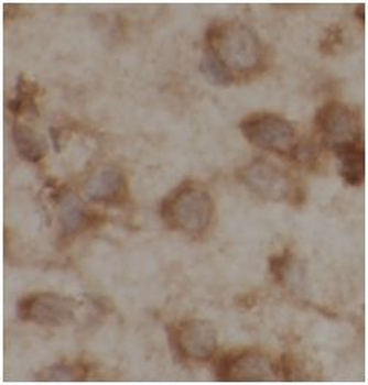 SLC1A1 Antibody