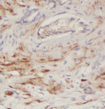 ECHS1 Antibody
