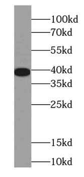 EEF1D Mouse Monoclonal Antibody