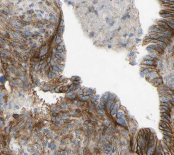 EEF1D Mouse Monoclonal Antibody