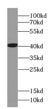 EEF1D Mouse Monoclonal Antibody
