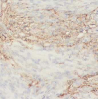 EPHA6 Specific Rabbit Polyclonal Antibody