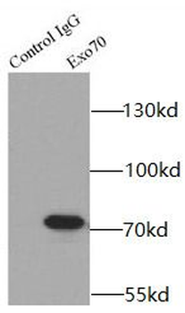 EXOC7 Rabbit Polyclonal Antibody