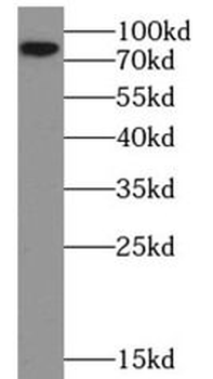 EXOC7 Rabbit Polyclonal Antibody
