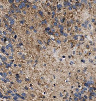 EXOC7 Rabbit Polyclonal Antibody