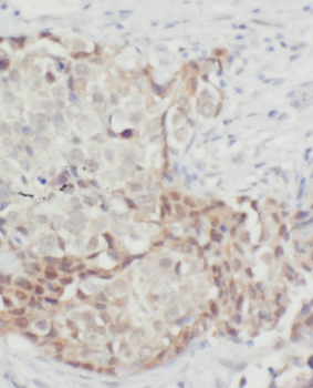 FABP7 Specific Rabbit Polyclonal Antibody