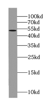 ABRAXAS1 Rabbit Polyclonal Antibody