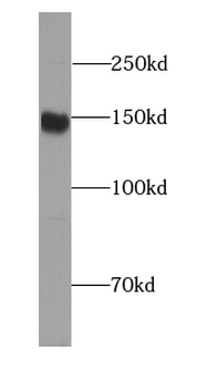 phospho FANCD2 Rabbit Polyclonal Antibody