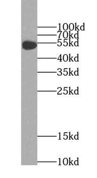FCER1A Rabbit Polyclonal Antibody