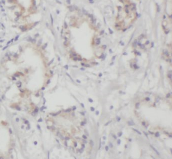 FCER1A Rabbit Polyclonal Antibody