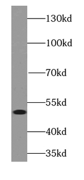 FOXL2 Antibody