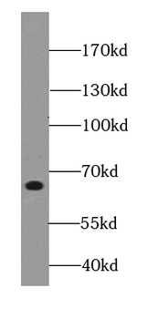 FZD10 Antibody