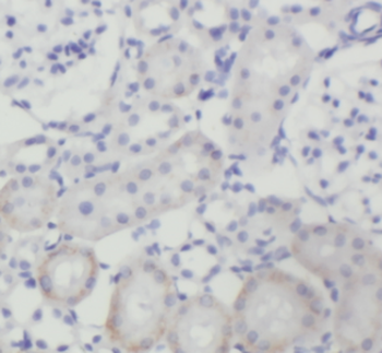 FZD10 Antibody