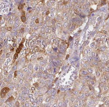 GABARAPL1 Antibody