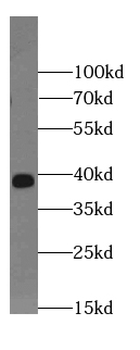 LGALS4 Rabbit Polyclonal Antibody
