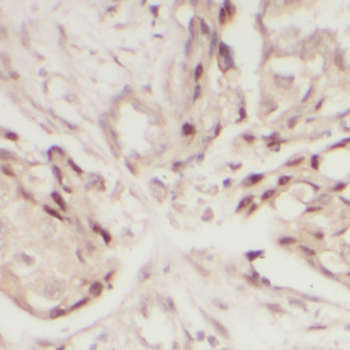 LGALS4 Rabbit Polyclonal Antibody