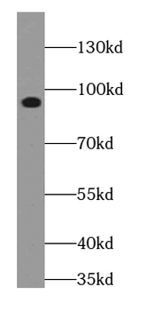 ADD3 Rabbit Polyclonal Antibody