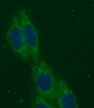 CTH Rabbit Polyclonal Antibody