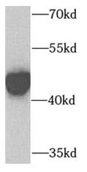 CTH Rabbit Polyclonal Antibody