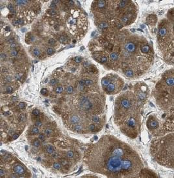 CTH Rabbit Polyclonal Antibody