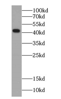 CTH Mouse Monoclonal Antibody