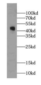 GDI2 Mouse Monoclonal Antibody