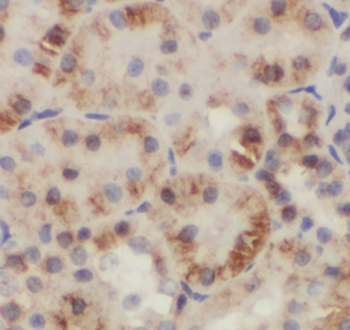 GDI2 Mouse Monoclonal Antibody