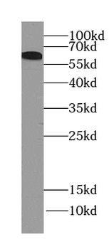 ARHGEF25 Specific Rabbit Polyclonal Antibody