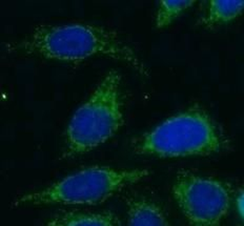 GOLGB1 Rabbit Polyclonal Antibody