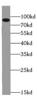 QARS1 Rabbit Polyclonal Antibody